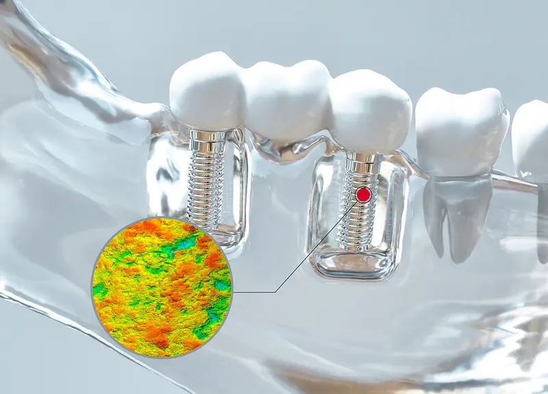 [Translate to English (International):] 